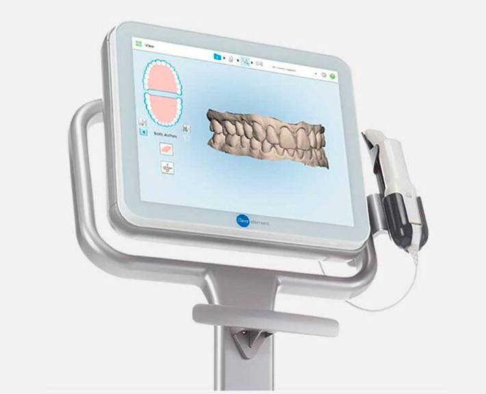 ESCANEAMENTO INTRAORAL