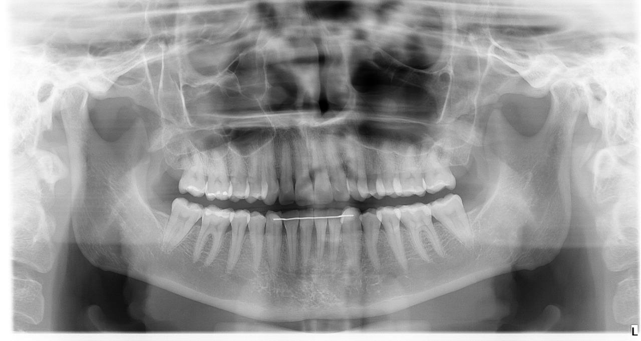 RADIOGRAFIA PANORÂMICA